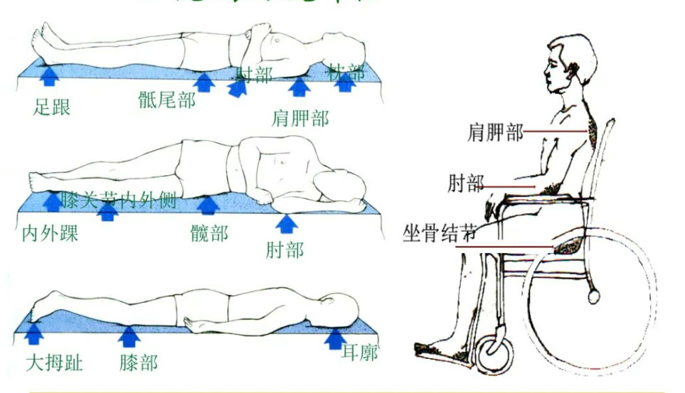 科学的卧床护理